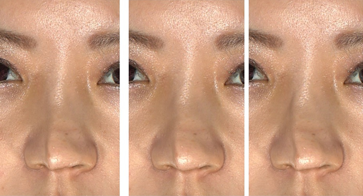 左右 非対称 鼻 目が左右非対称になる原因は？改善方法を知ろう！非対称なのは本当に良くないの？